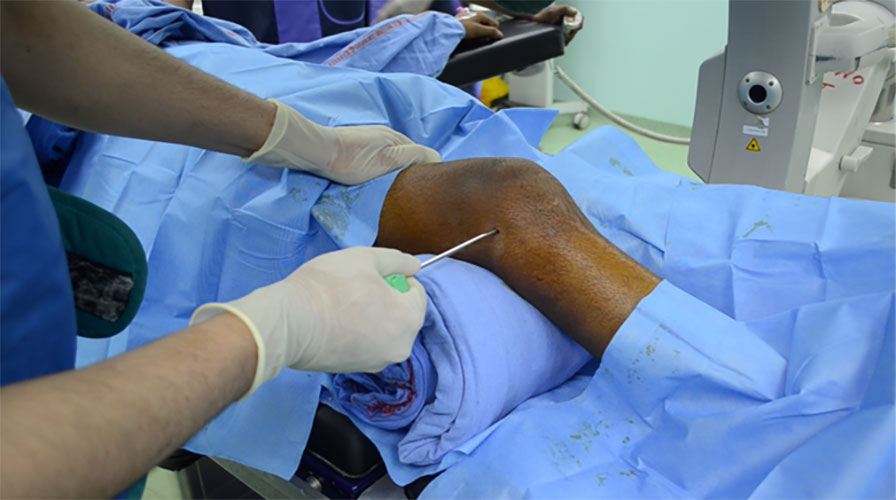 Core needle biopsy of a bone tumor performed under image guidance for accurate tissue diagnosis