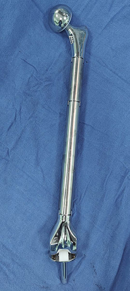 Total Femur Megaprosthesis Total Femur Megaprosthesis